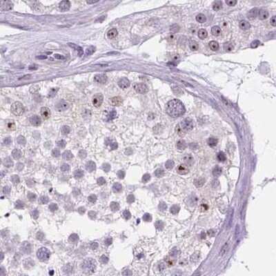 Immunohistochemistry-Paraffin: NHP2 Antibody [NBP2-13656]