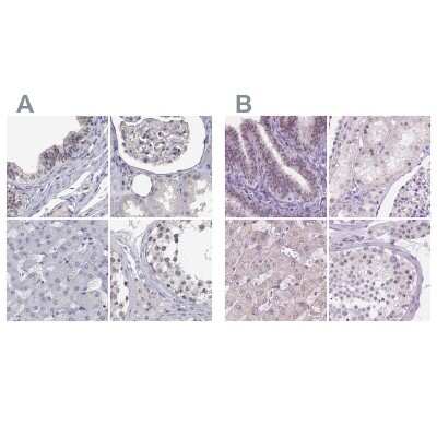 Immunohistochemistry-Paraffin: NHP2 Antibody [NBP2-38626]