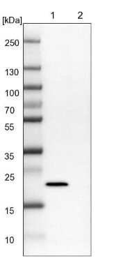 Western Blot: NHP2 Antibody [NBP2-13656]