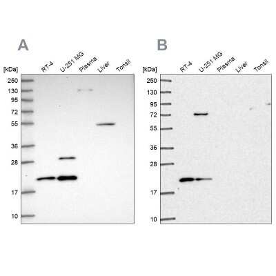 Western Blot: NHP2 Antibody [NBP2-13656]