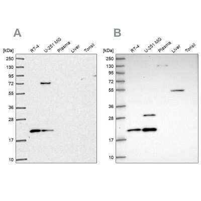 Western Blot: NHP2 Antibody [NBP2-38626]