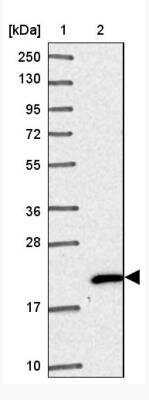 Western Blot: NHP2 Antibody [NBP2-38626]