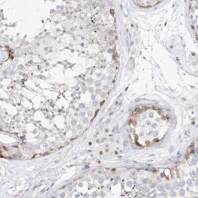 Immunohistochemistry-Paraffin: NHP2L1 Antibody [NBP1-89406]