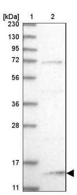 Western Blot: NHP2L1 Antibody [NBP1-89406]