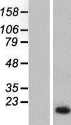 Western Blot: NHP2L1 Overexpression Lysate [NBP2-07801]