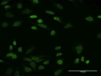 Immunocytochemistry/ Immunofluorescence: NHS Antibody (6D9) [H00004810-M05]