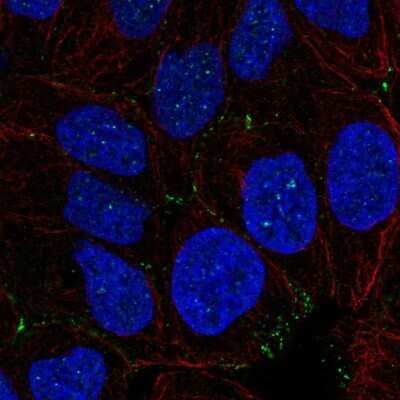 Immunocytochemistry/ Immunofluorescence: NHS Antibody [NBP2-56313]