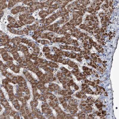 Immunohistochemistry-Paraffin: NHS Antibody [NBP1-86329]