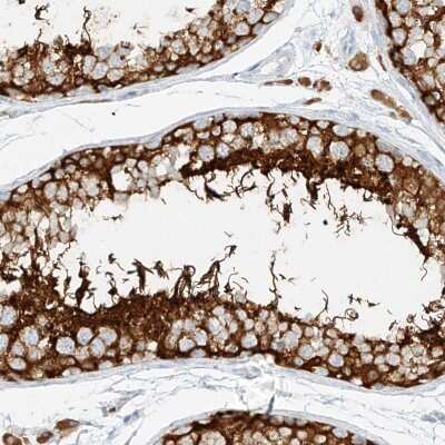 Immunohistochemistry: NHSL1 Antibody [NBP2-38149]