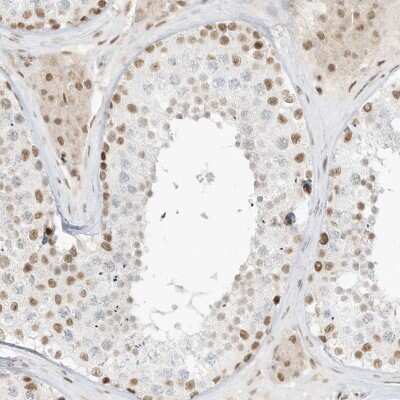 Immunohistochemistry-Paraffin: NHSL1 Antibody [NBP1-90025]