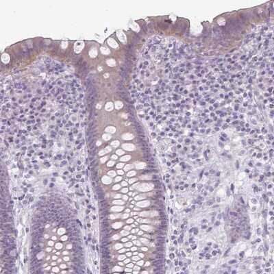 Immunohistochemistry-Paraffin: NHSL2 Antibody [NBP2-30459]