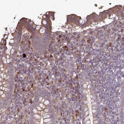 Immunohistochemistry-Paraffin: NHSL2 Antibody [NBP2-30932]