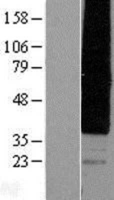 Western Blot: HM74A/PUMA-G/GPR109A/NIACR1 Overexpression Lysate [NBP2-05008]