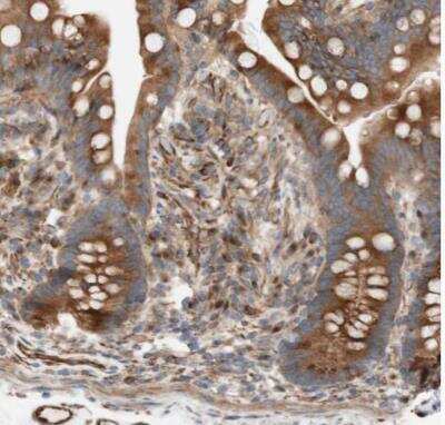 Immunohistochemistry-Paraffin: NICE-3 Antibody [NBP1-87986]