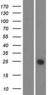 Western Blot: NICE-3 Overexpression Lysate [NBP2-05631]