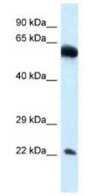 Western Blot: NICN1 Antibody [NBP1-79827]