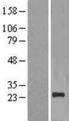 Western Blot: NICN1 Overexpression Lysate [NBL1-13640]