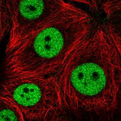 Immunocytochemistry/ Immunofluorescence: NIF1 Antibody [NBP2-55922]