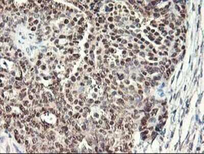 Immunohistochemistry: NIF3L1 Antibody (OTI5A7) - Azide and BSA Free [NBP2-72988]