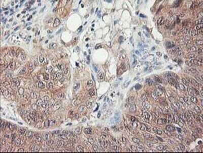 Immunohistochemistry: NIF3L1 Antibody (OTI5A7) - Azide and BSA Free [NBP2-72988]