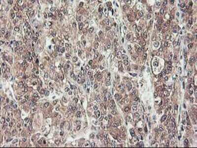 Immunohistochemistry: NIF3L1 Antibody (OTI5A7) - Azide and BSA Free [NBP2-72988]