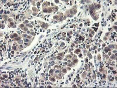 Immunohistochemistry: NIF3L1 Antibody (OTI5A7) - Azide and BSA Free [NBP2-72988]
