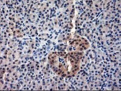 Immunohistochemistry: NIF3L1 Antibody (OTI5A7) - Azide and BSA Free [NBP2-72988]