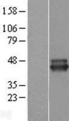 Western Blot: NIF3L1 Overexpression Lysate [NBP2-09598]