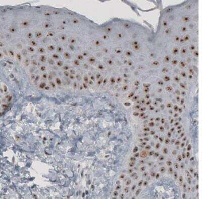 Immunohistochemistry: NIFK Antibody (CL2237) [NBP2-36750]