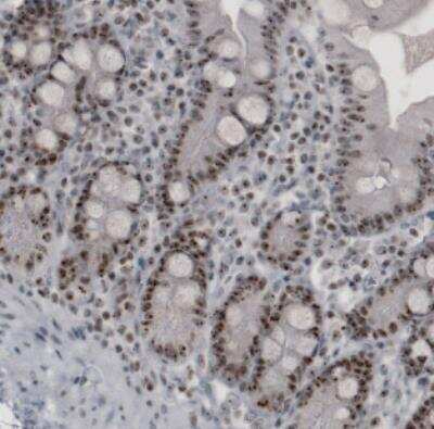 Immunohistochemistry: NIFK Antibody (CL2237) [NBP2-36750]