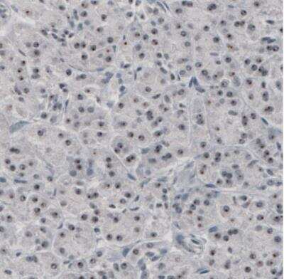 Immunohistochemistry: NIFK Antibody (CL2237) [NBP2-36750]