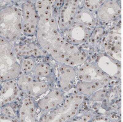 Immunohistochemistry: NIFK Antibody (CL2237) [NBP2-36750]