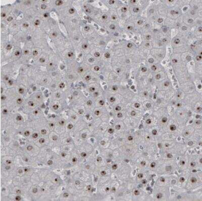 Immunohistochemistry: NIFK Antibody (CL2237) [NBP2-36750]