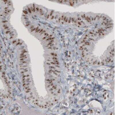 Immunohistochemistry: NIFK Antibody (CL2237) [NBP2-36750]