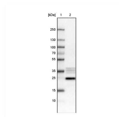 Western Blot: NIFK Antibody (CL2237) [NBP2-36750]