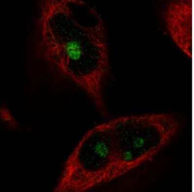 Immunocytochemistry/ Immunofluorescence: NIFK Antibody (CL2240) [NBP2-36749]