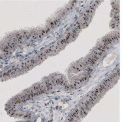 Immunohistochemistry: NIFK Antibody (CL2240) [NBP2-36749]