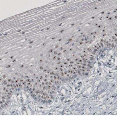 Immunohistochemistry: NIFK Antibody (CL2240) [NBP2-36749]