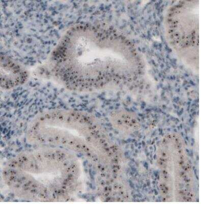 Immunohistochemistry: NIFK Antibody (CL2240) [NBP2-36749]