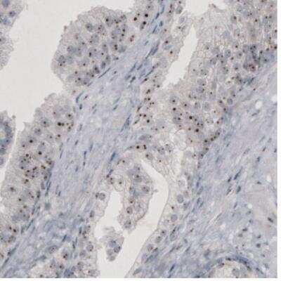 Immunohistochemistry: NIFK Antibody (CL2240) [NBP2-36749]