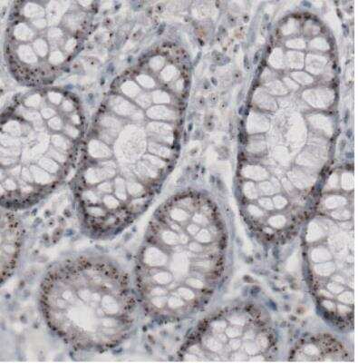Immunohistochemistry: NIFK Antibody (CL2240) [NBP2-36749]