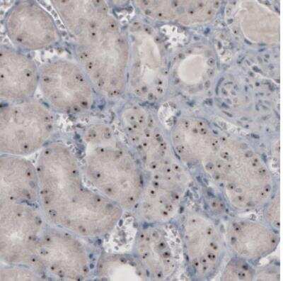 Immunohistochemistry: NIFK Antibody (CL2240) [NBP2-36749]