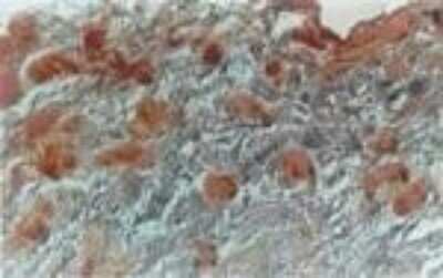 Immunohistochemistry: NIFK Antibody [NB100-56660]