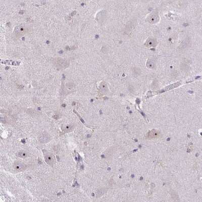 Immunohistochemistry: NIFK Antibody [NBP2-48643]