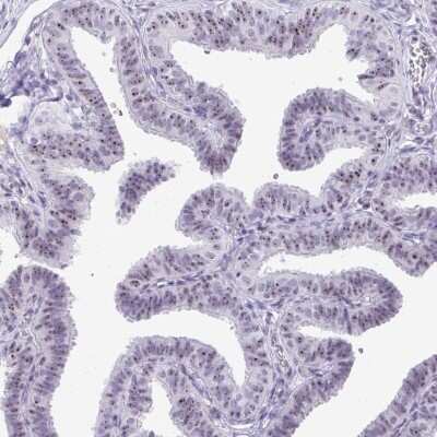 Immunohistochemistry-Paraffin: NIFK Antibody [NBP2-48642]