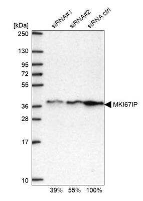 Western Blot: NIFK Antibody [NBP2-48642]