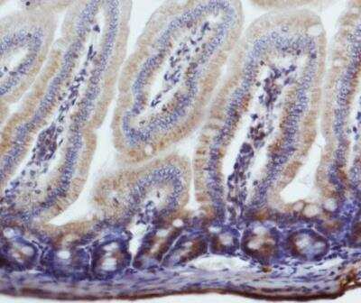 Immunohistochemistry: NIK/MAP3K14 Antibody - BSA Free [NBP2-23603]
