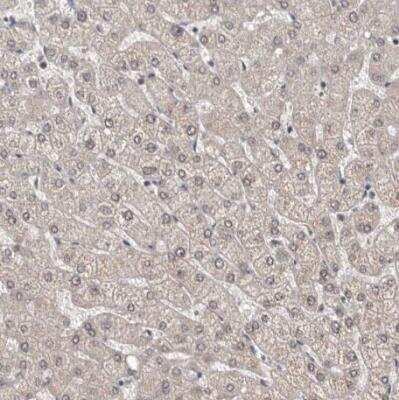 Immunohistochemistry-Paraffin: NIK/MAP3K14 Antibody [NBP1-83414]