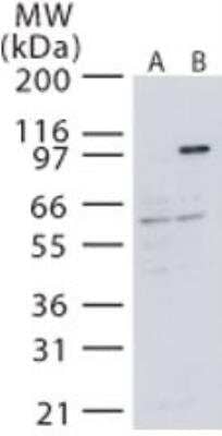 Western Blot: NIK/MAP3K14 Antibody [NB100-56367]