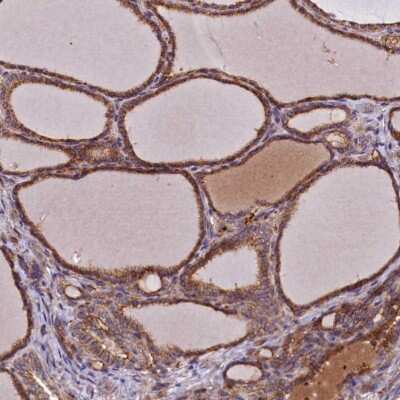 Immunohistochemistry: NIP Antibody [NBP2-47356]